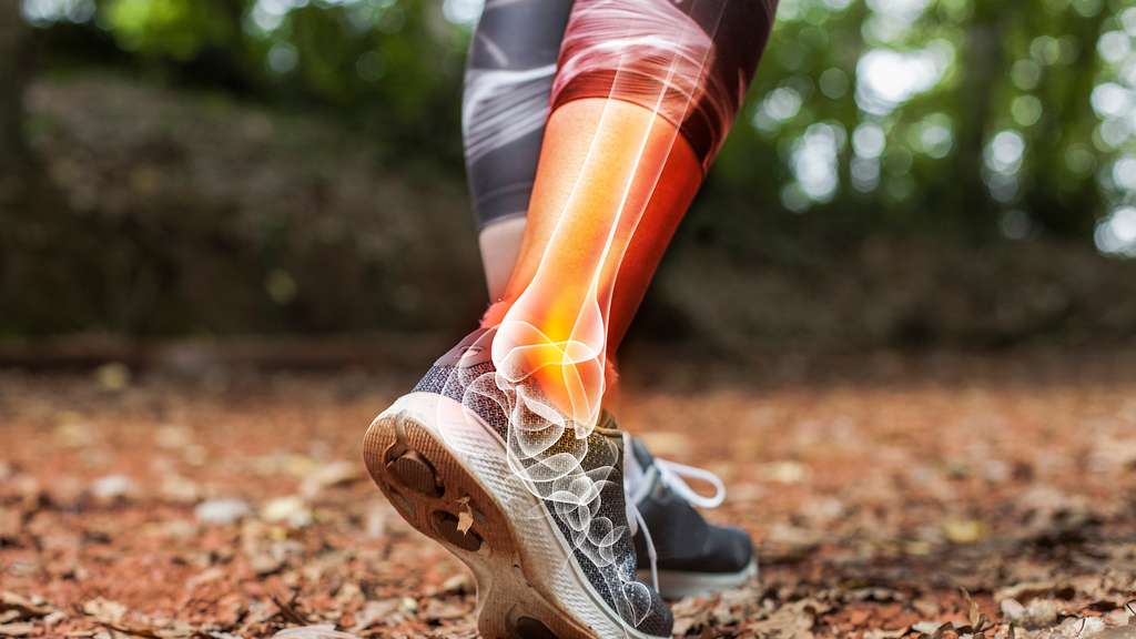 Lace-Up Ankle Brace: Your Complete Guide to Support