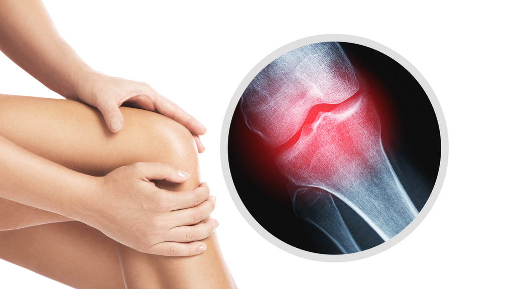 best knee brace after total knee replacement
