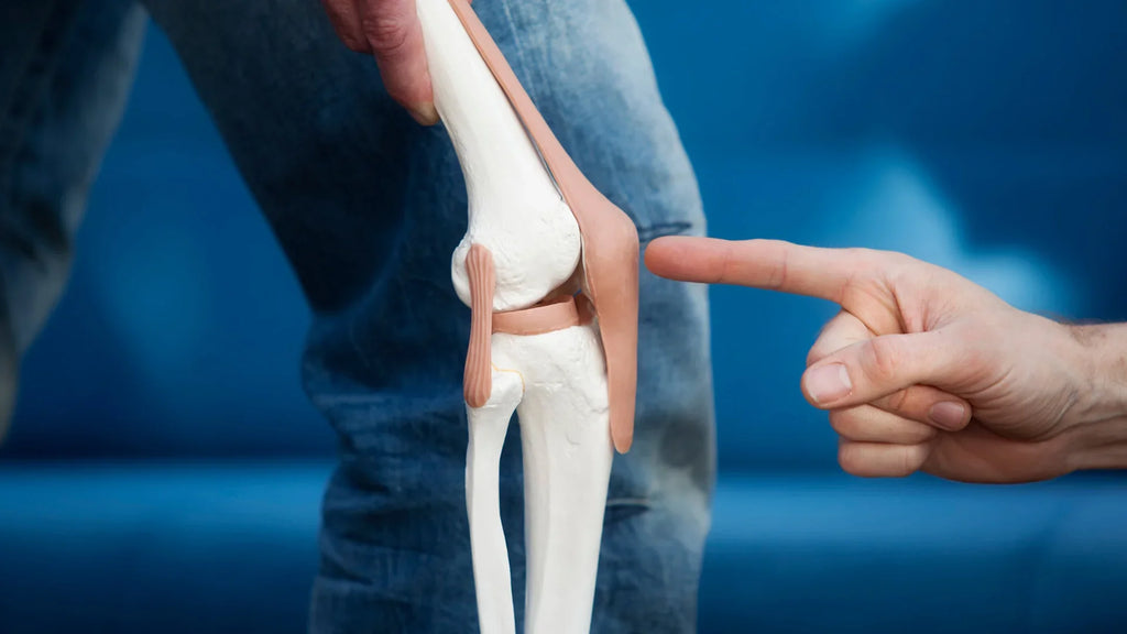 braces for patellofemoral pain