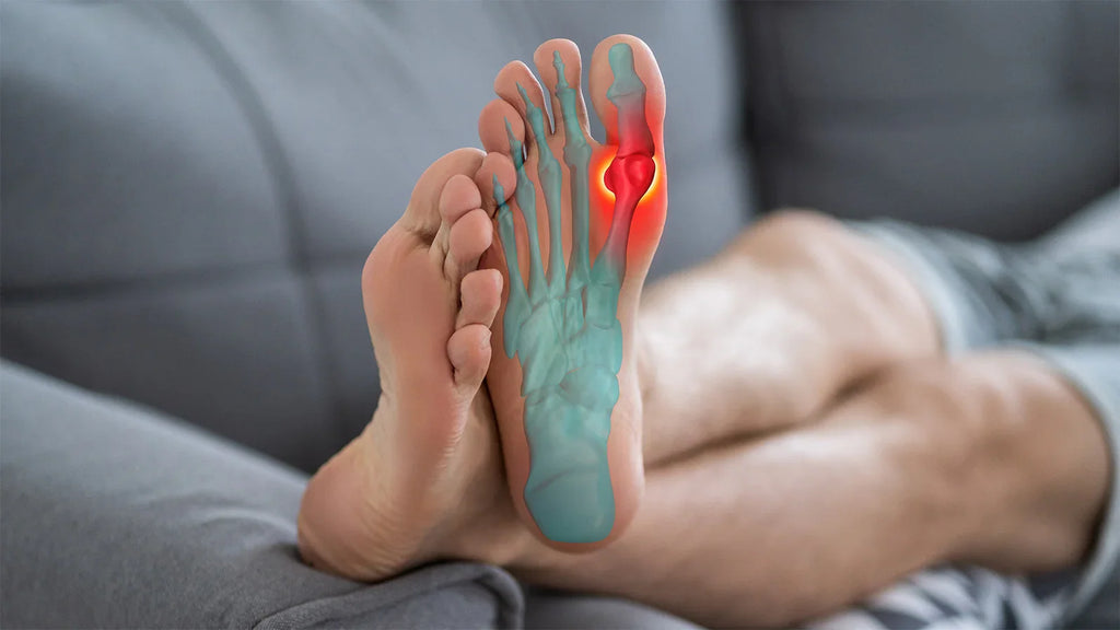 sprained ankle support